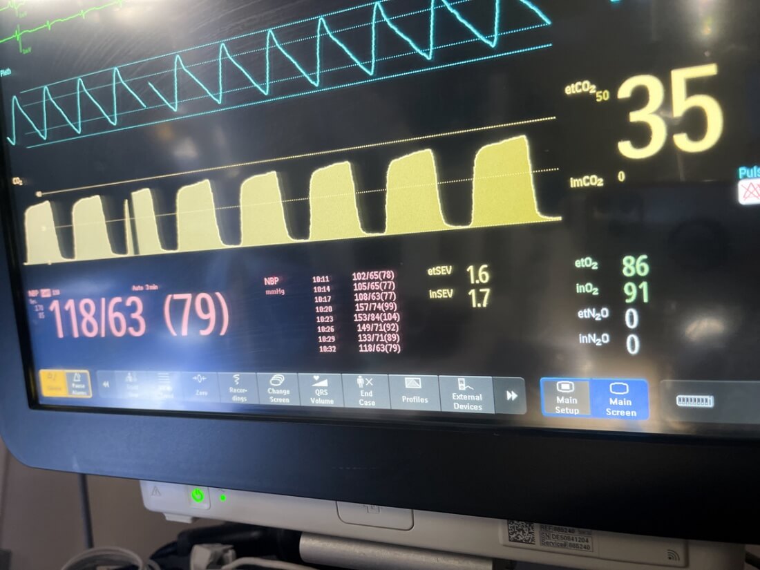 Intraoperative CO2 Monitoring